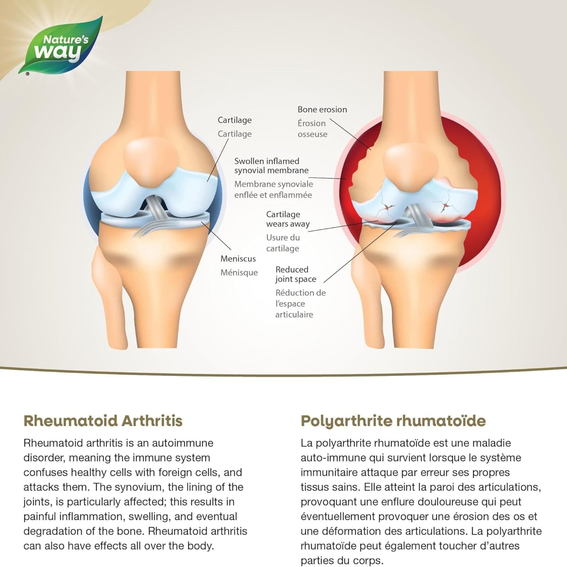 Citrus Flavour, 200 mL | Nature's Way NutraSea Arthritis Targeted Omega-3 Liquid