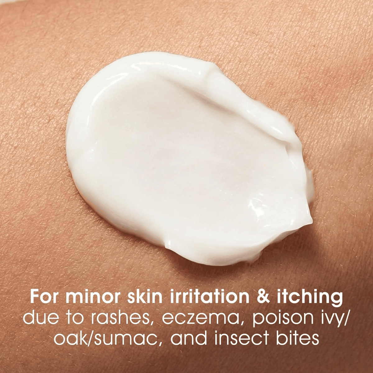 120ml | Naka Platinum Eczema Relief Cream